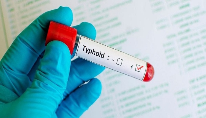Oti Typhoid Surge: Urgent Call for Vaccines and Medical Staff